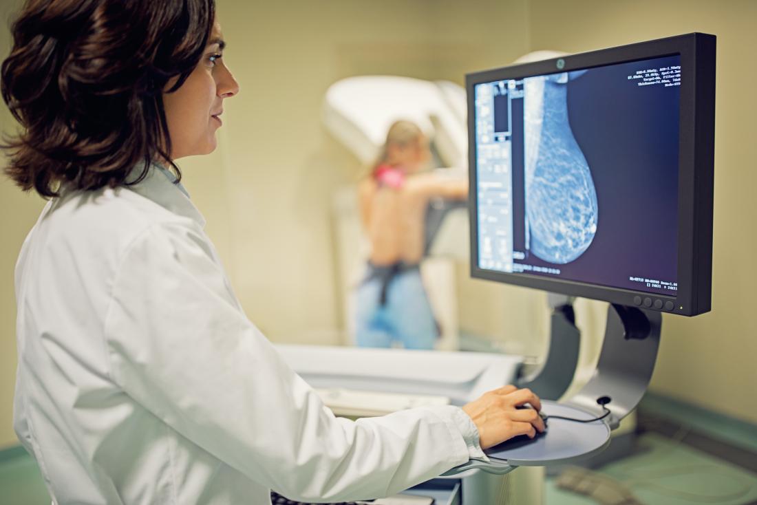 woman having mammogram to identify breast calcifications