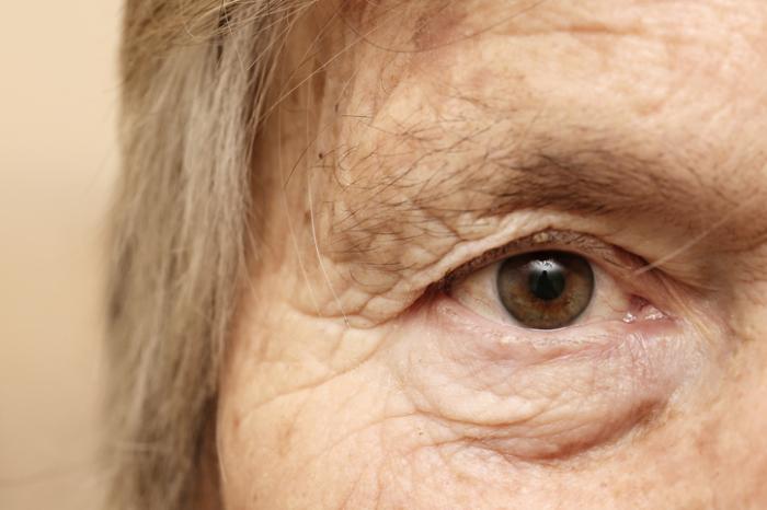 Understanding the Science Behind Aging Skin