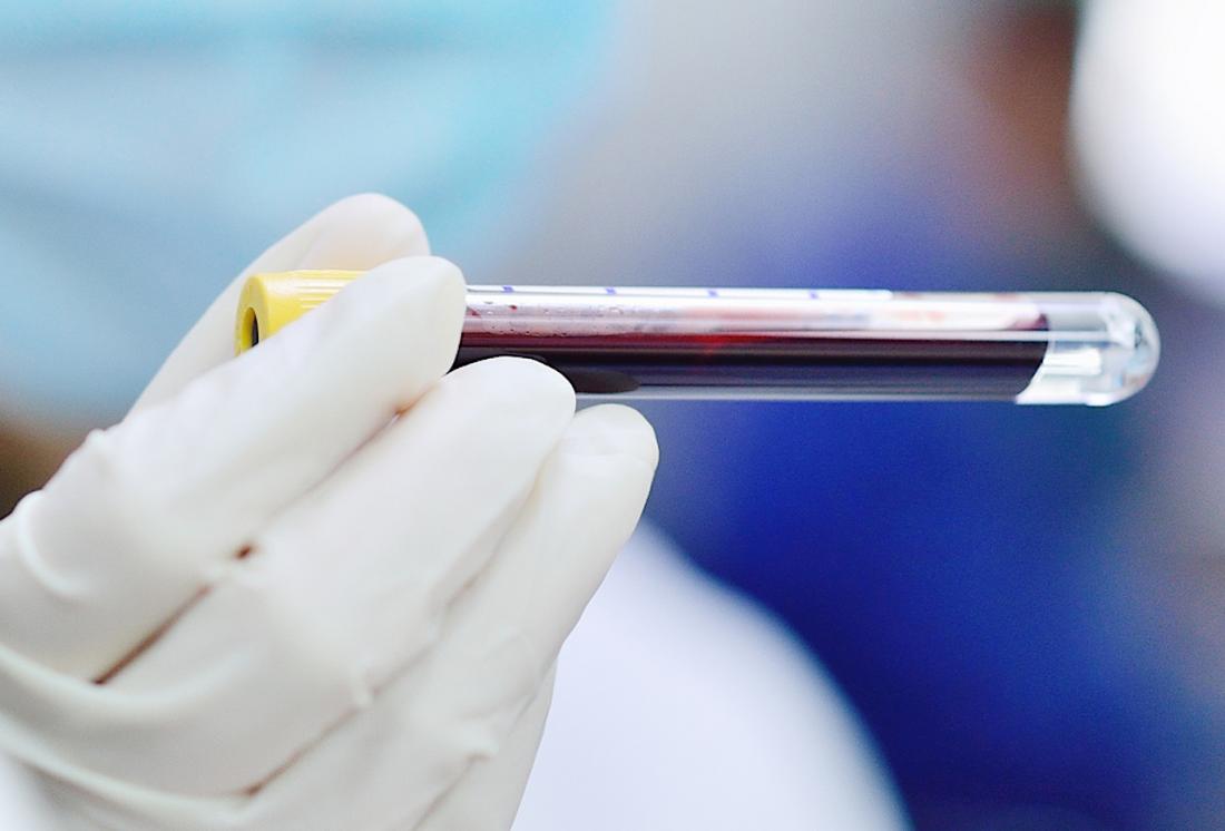 blood test
