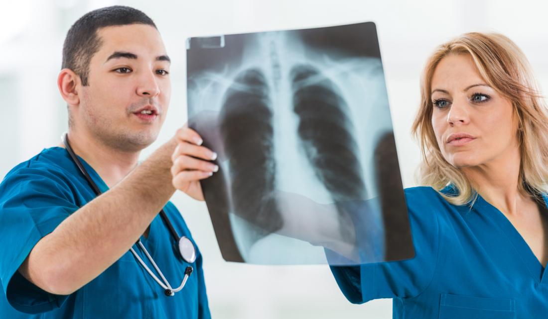 two surgeons looking at a lung X-ray