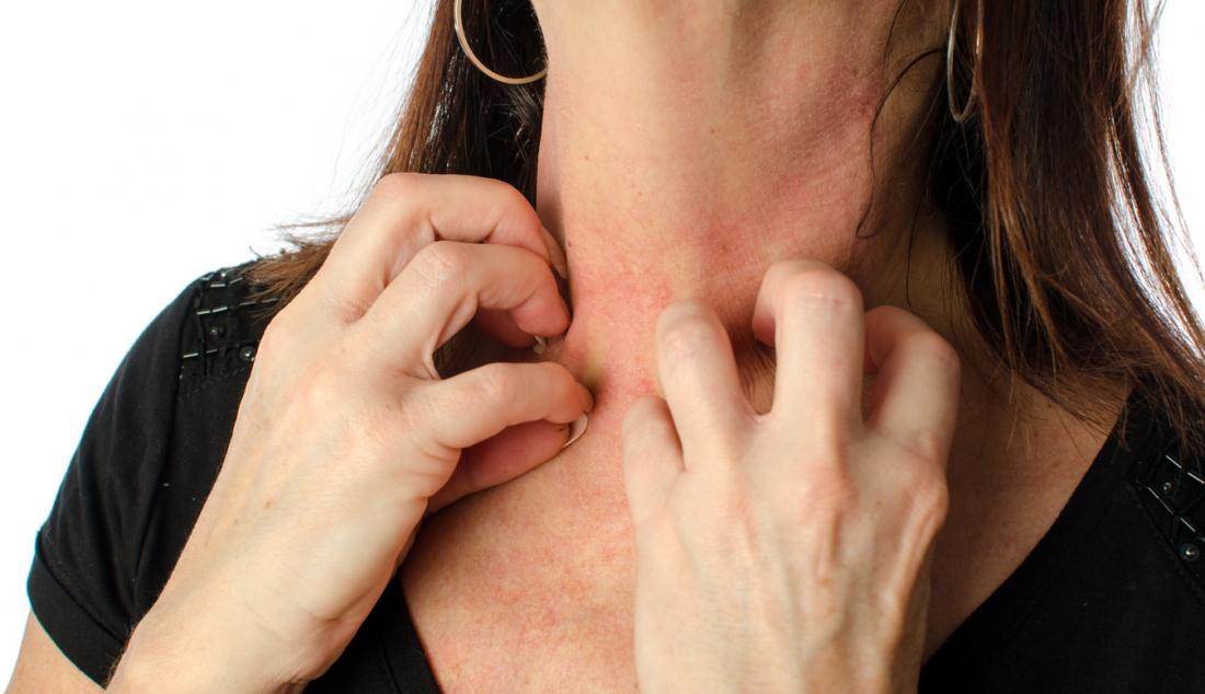 Women with symptoms of itchy urticaria or allergic reaction on the