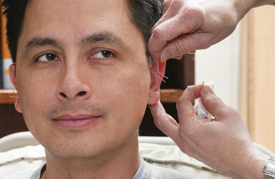 Daith Body Piercing Kit for Migraine Headache Relief