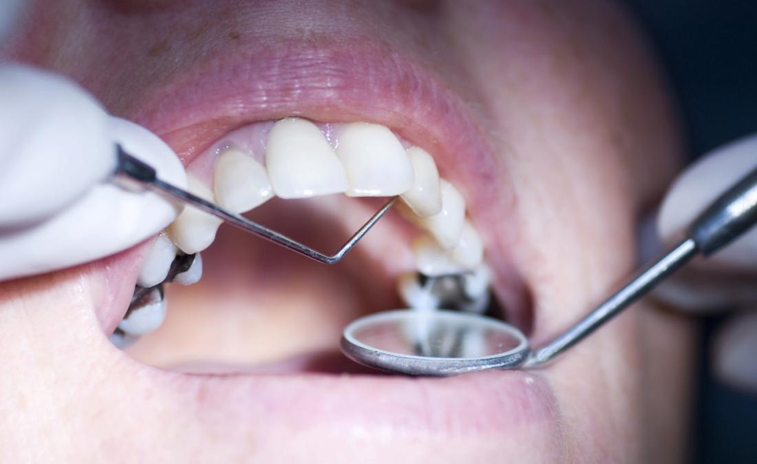 dentist inspects mouth