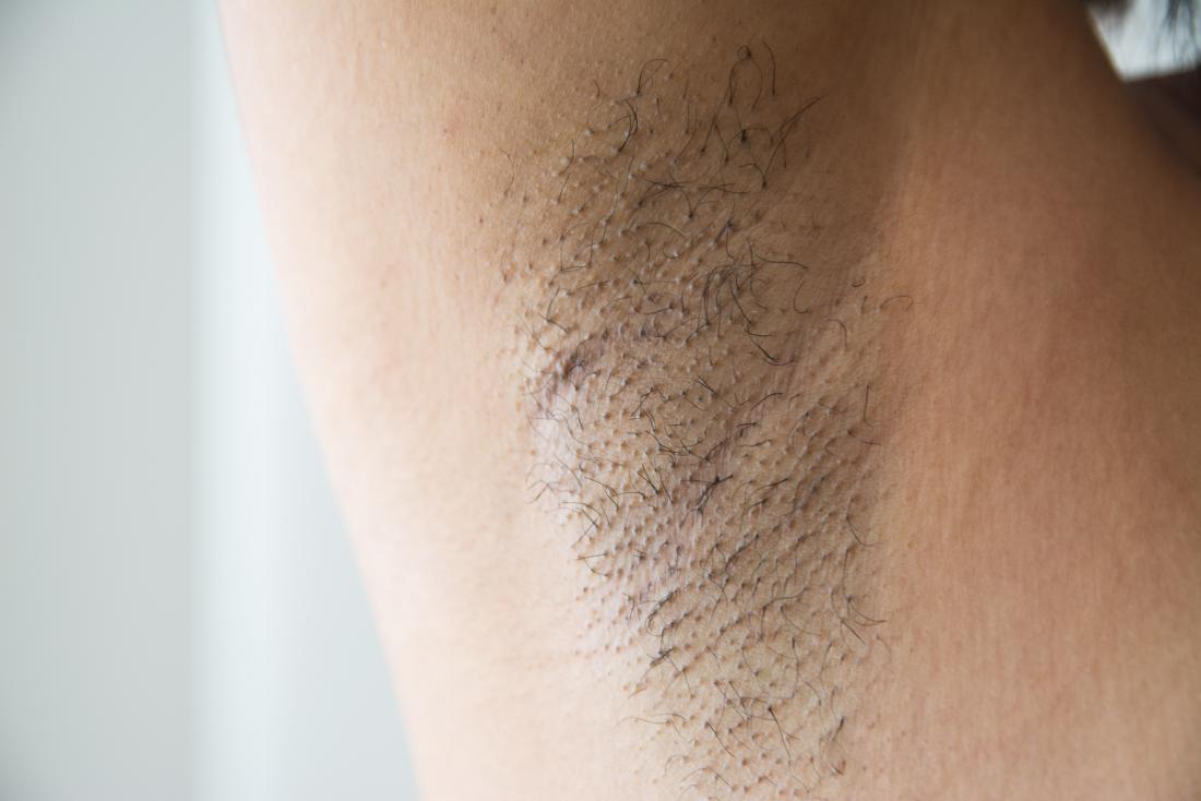 Many different factors can lead to armpit pain.