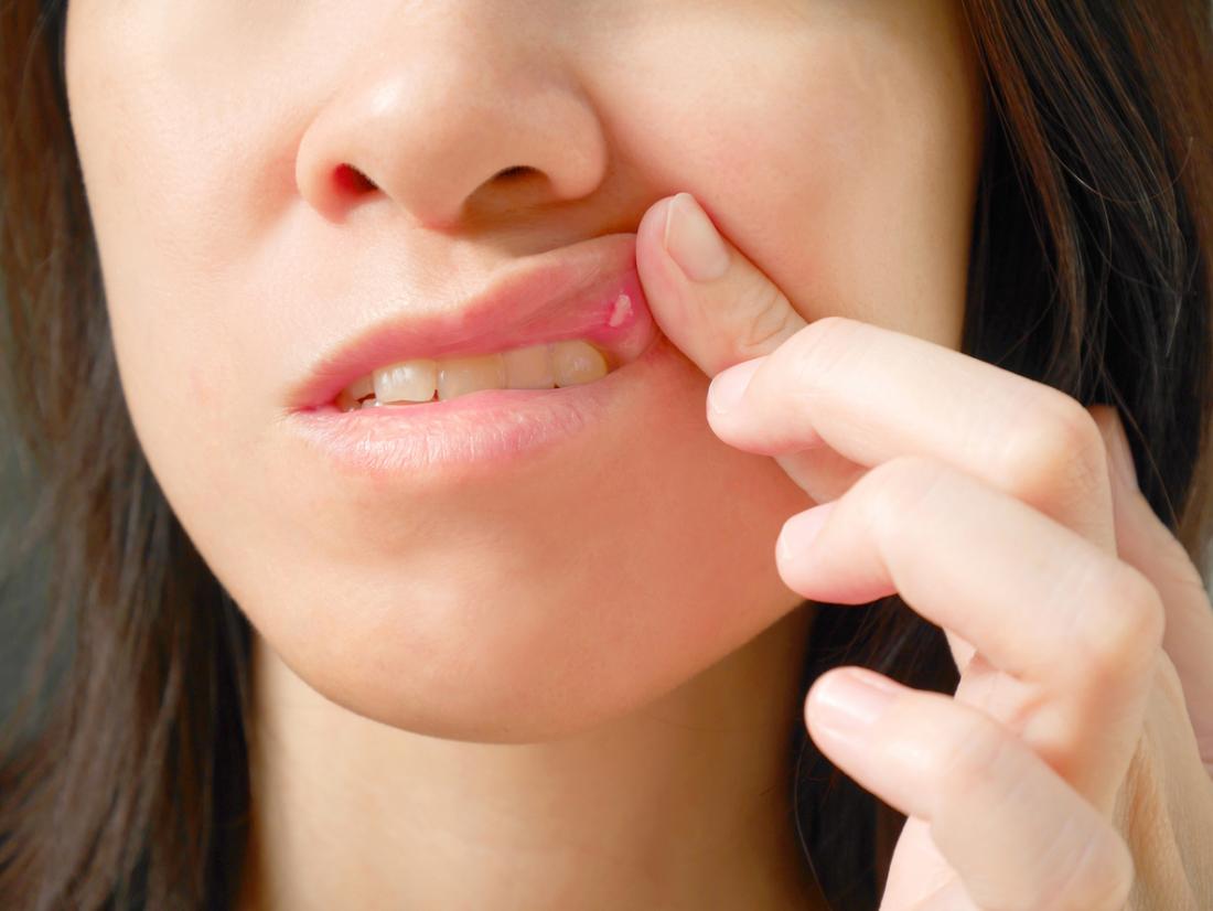 Allergic Reactions on The Lips: Causes and Treatments | LifeMD