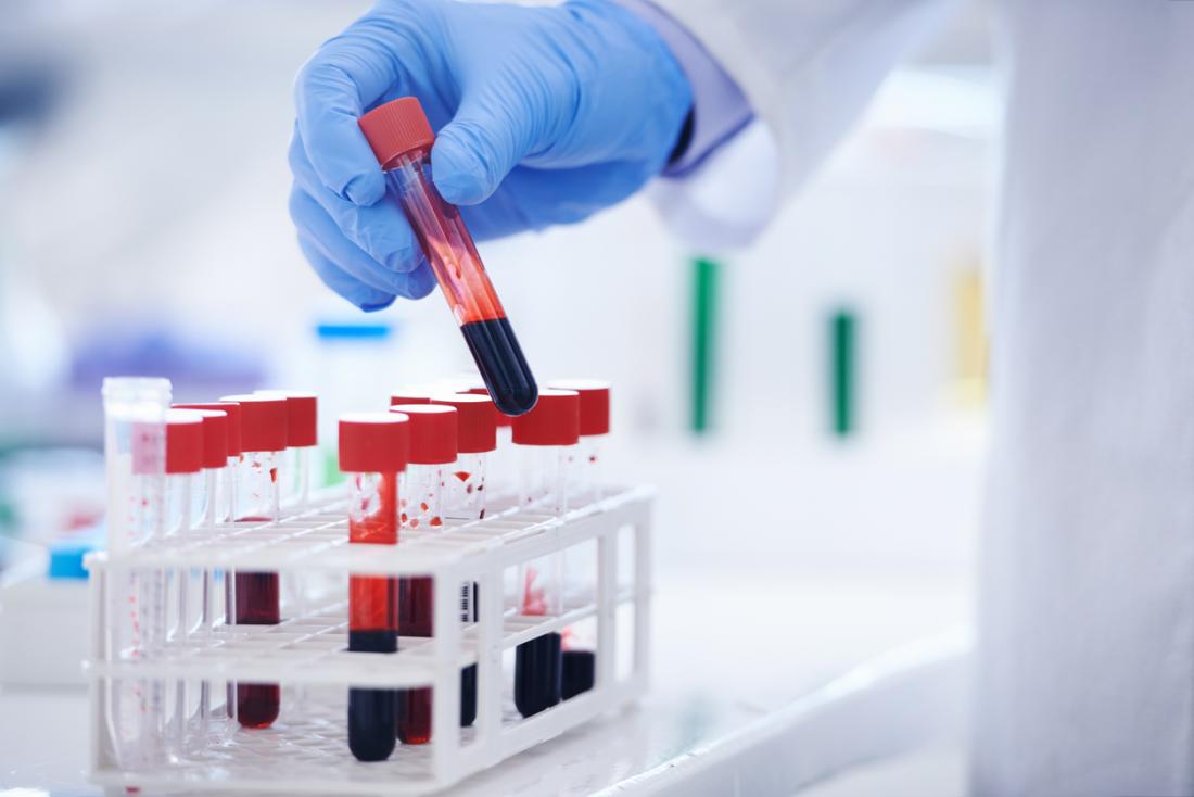 blood in some test tubes