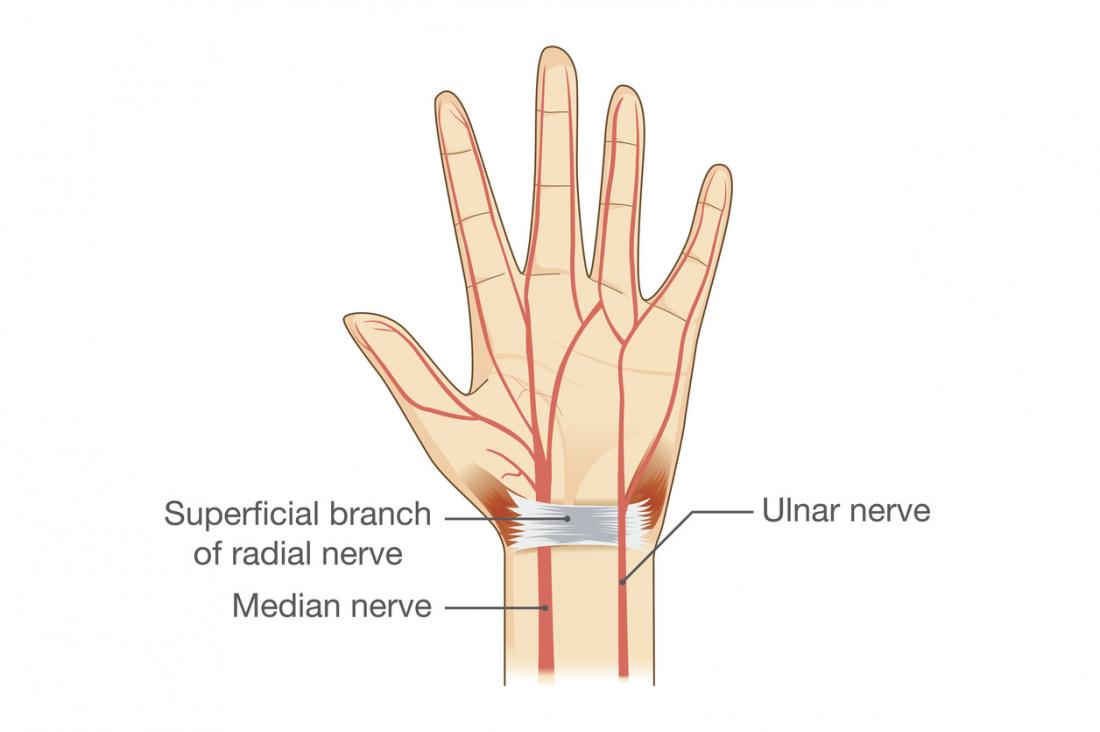 Ulnar Nerve Entrapment Causes And Symptoms