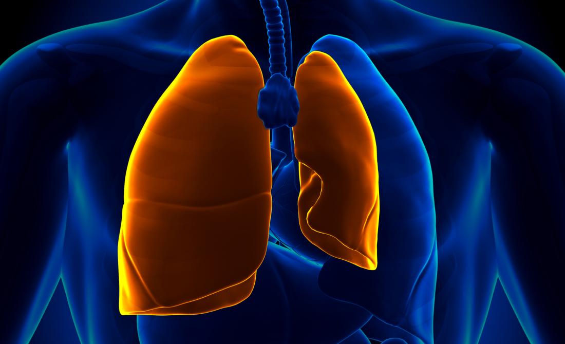 Pneumothorax Causes, symptoms, and treatment