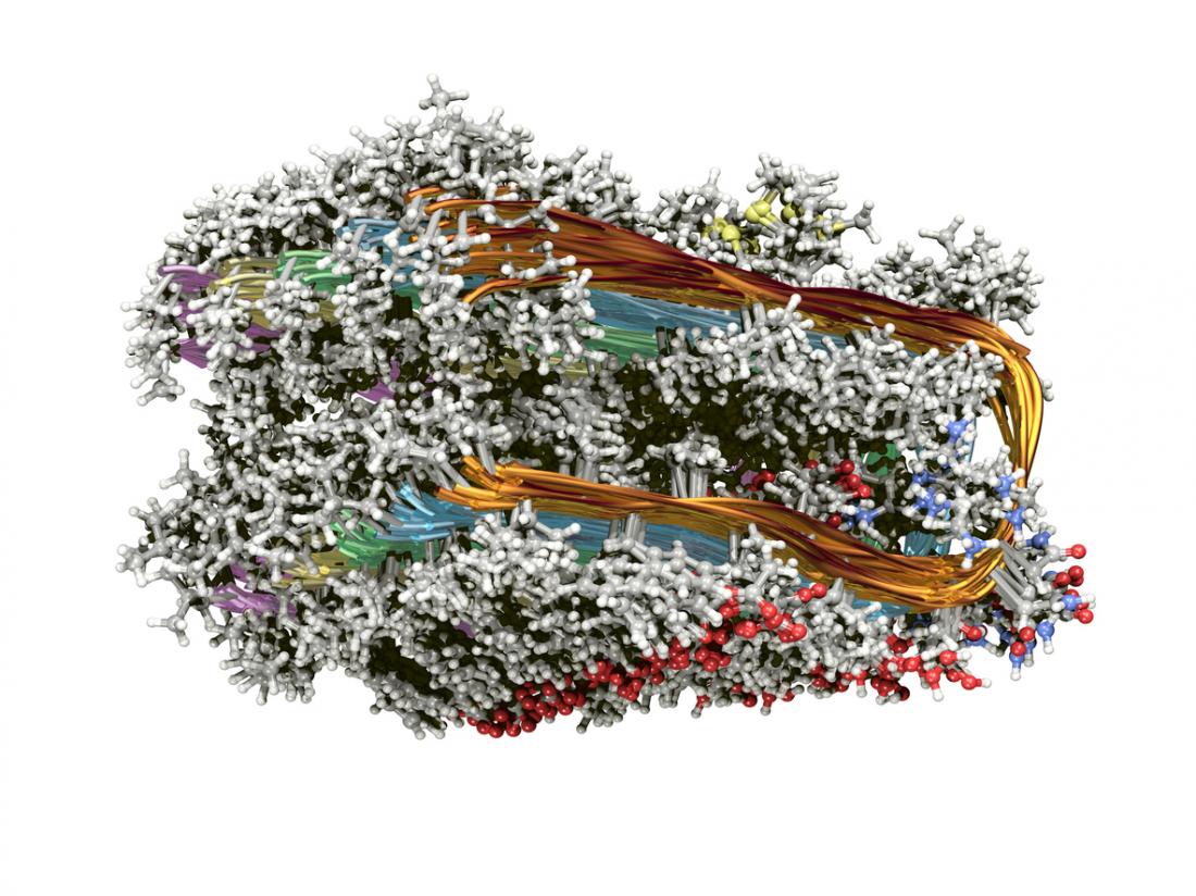 Alzheimer's Protein Fibril