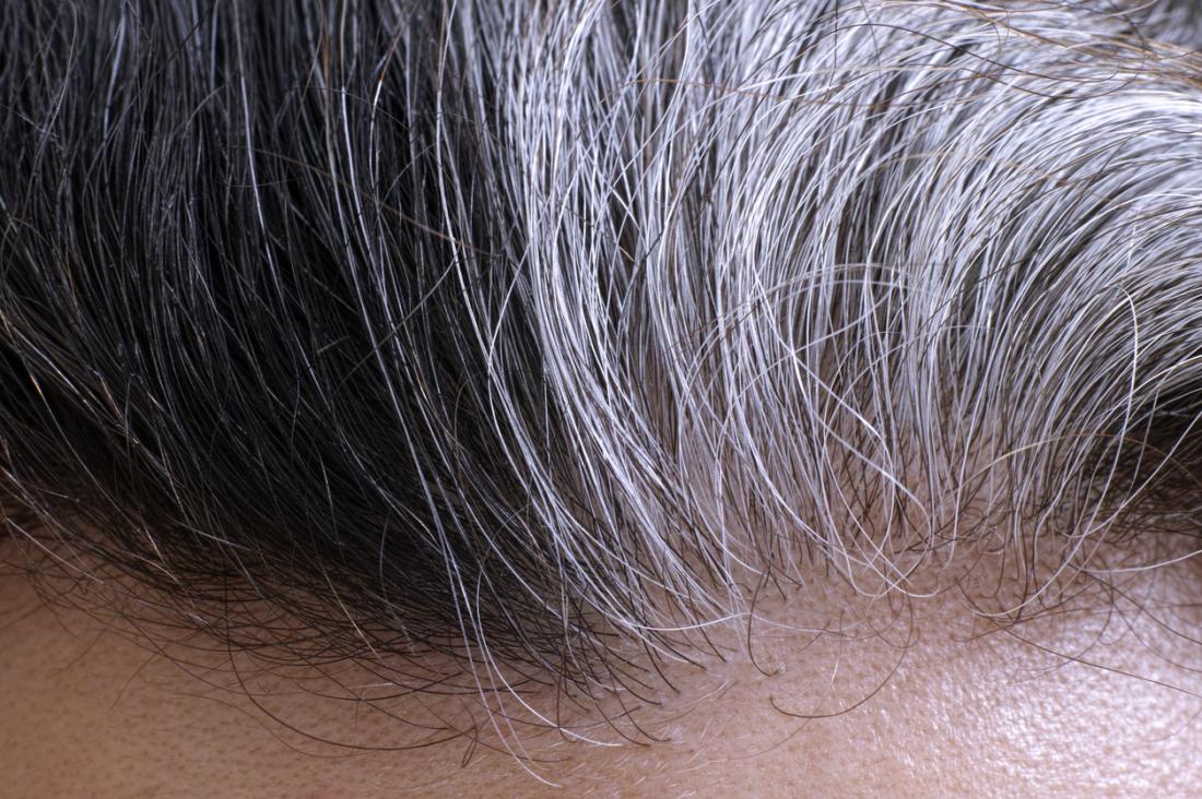 Why does hair turn gray?