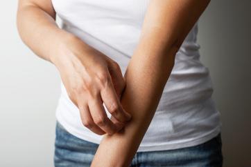 Woman itches her arm