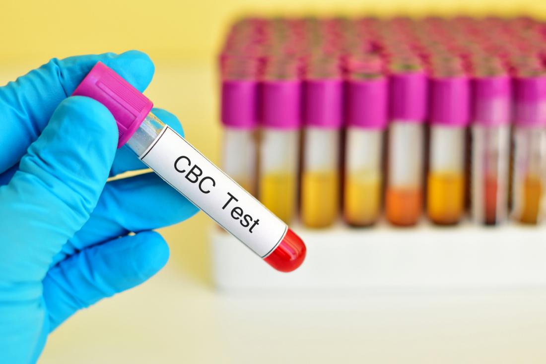MCH levels in complete blood count tests: High and low levels