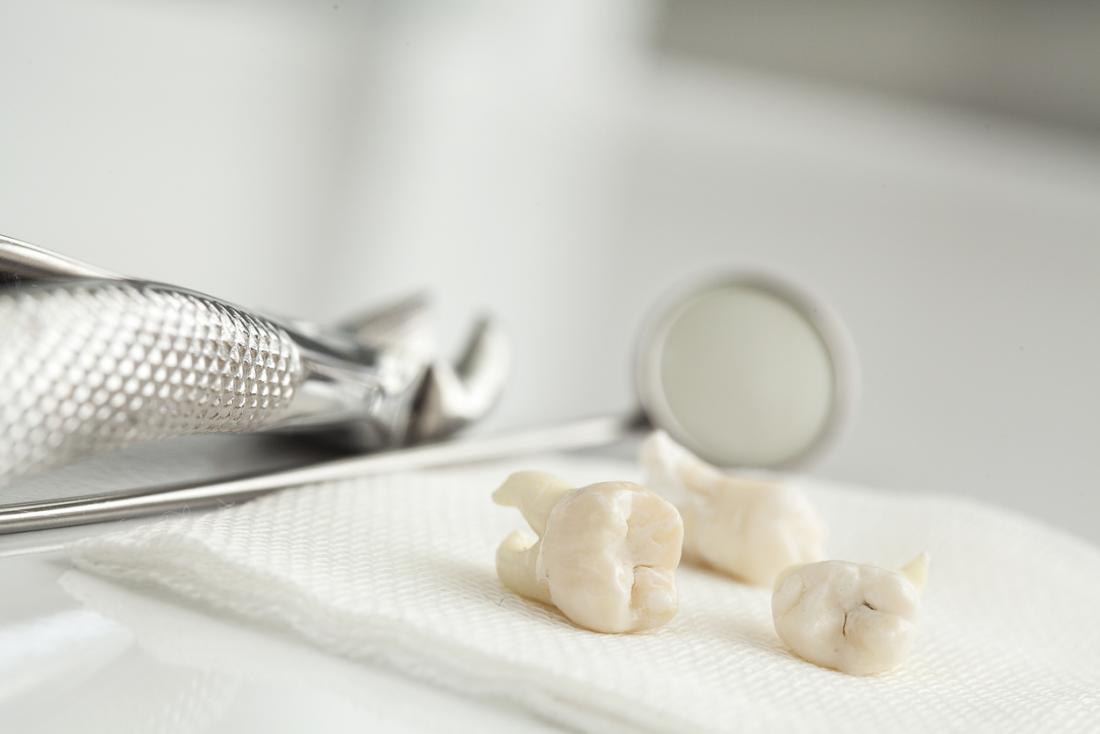 Extracted teeth on a white material