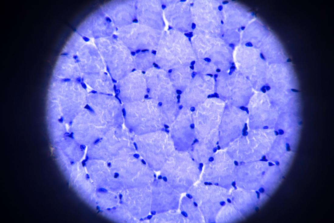 Microscopic image of skeletal muscle tissue cells.