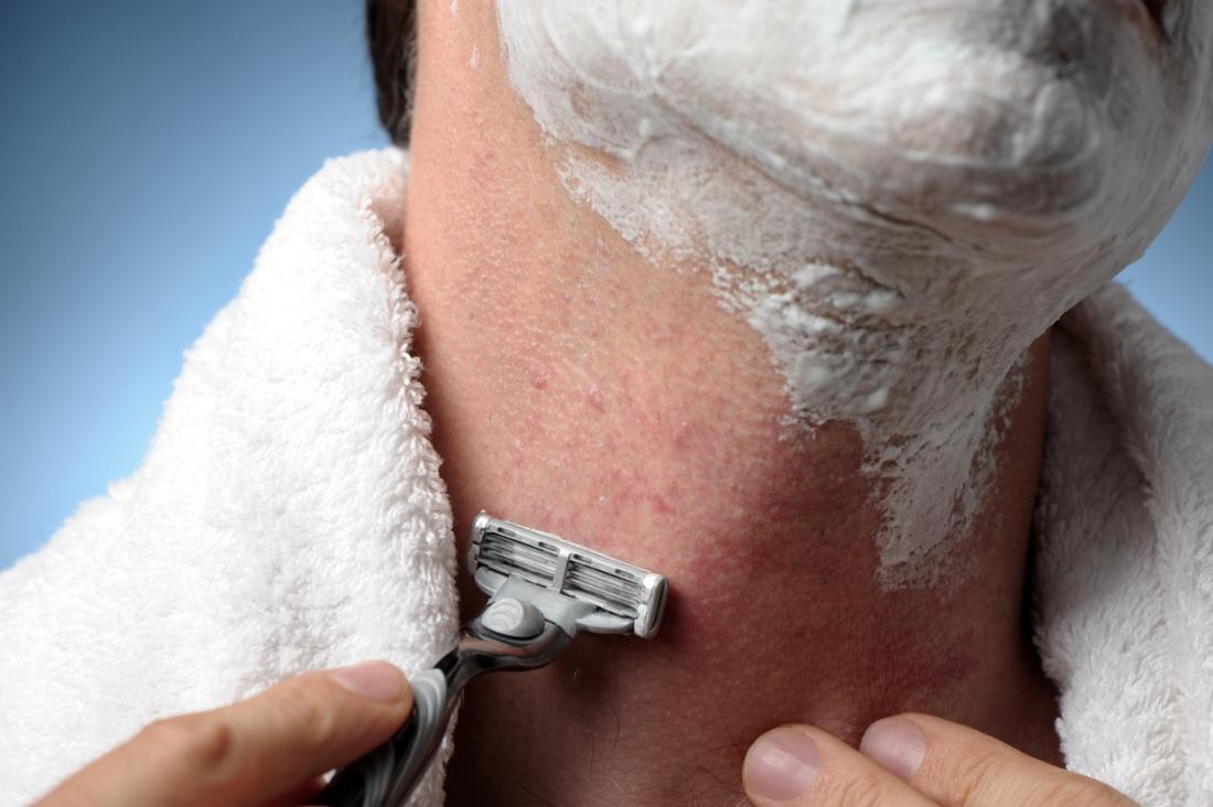 Your Guide to Razor Burn Treatments: How to Heal and Soothe Your