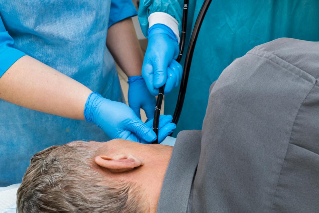 upper endoscopy