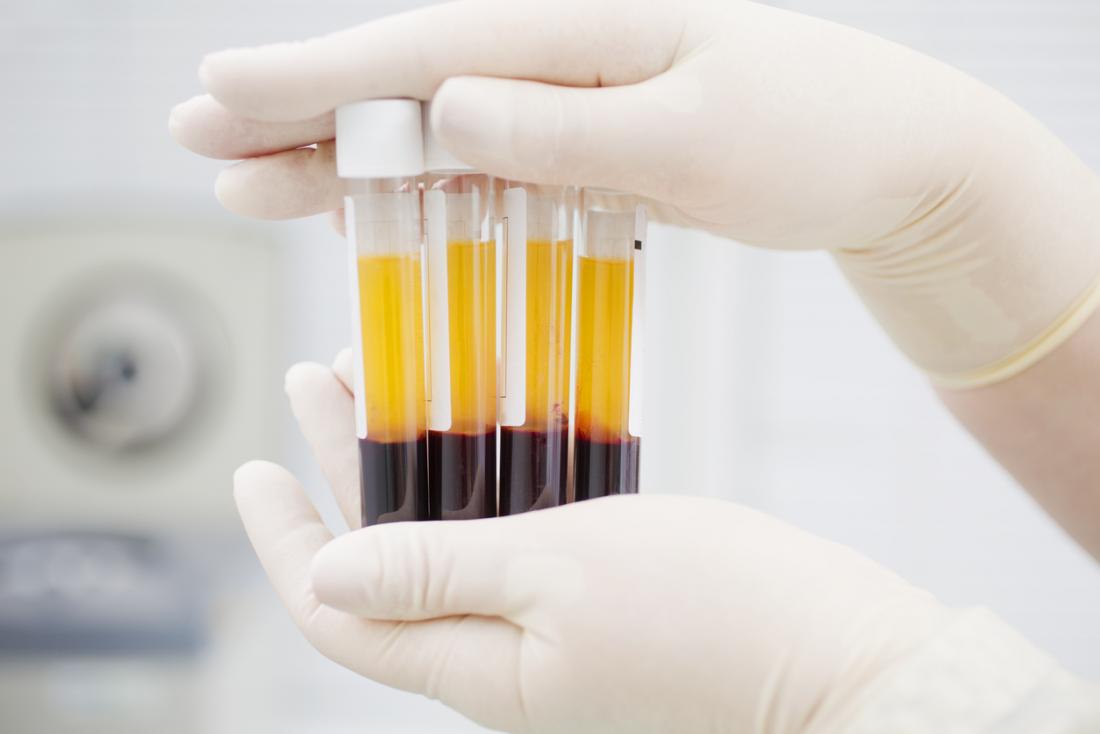 Blood plasma.