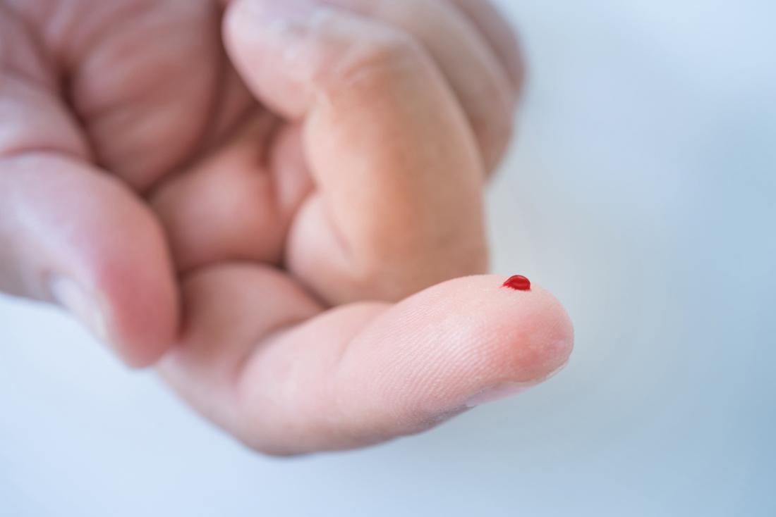 infected blood blister on finger