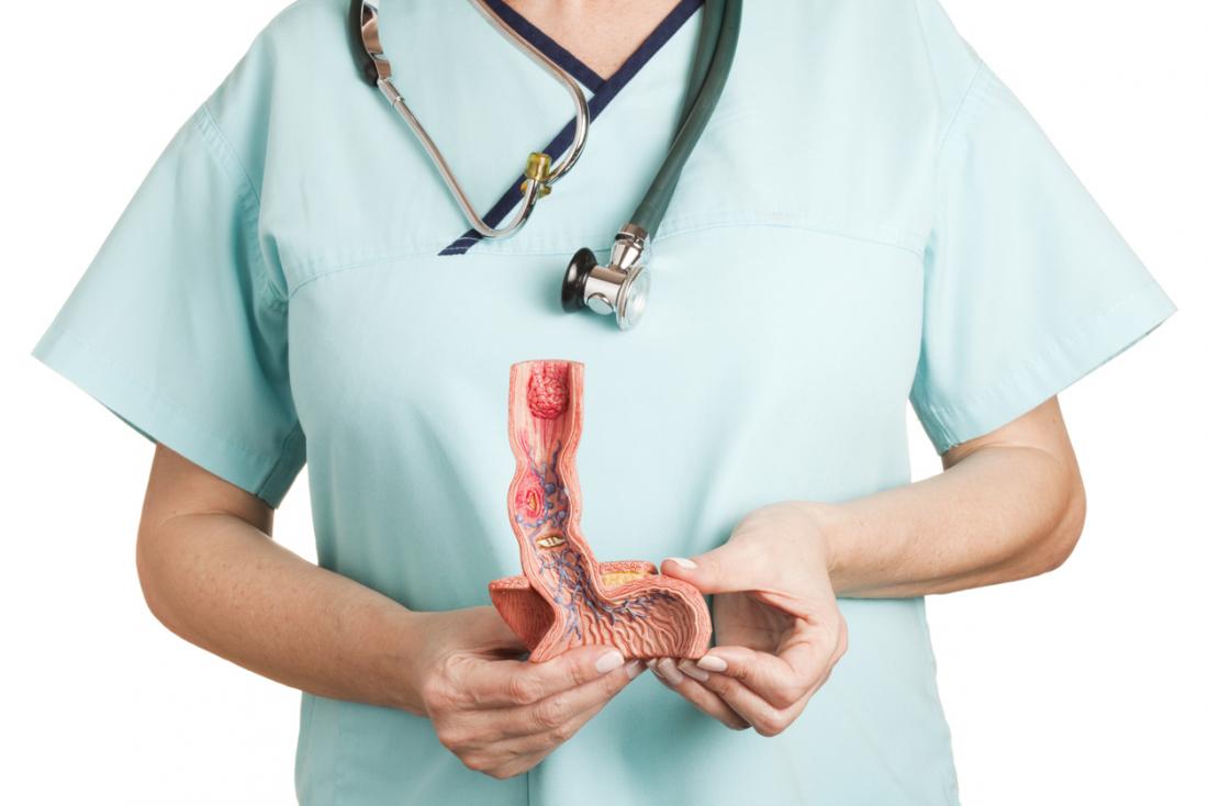 esophageal ulcer