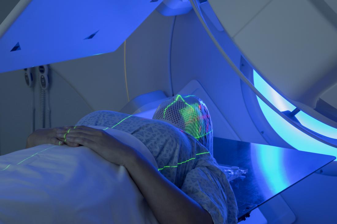 ependymoma radiotheraphy