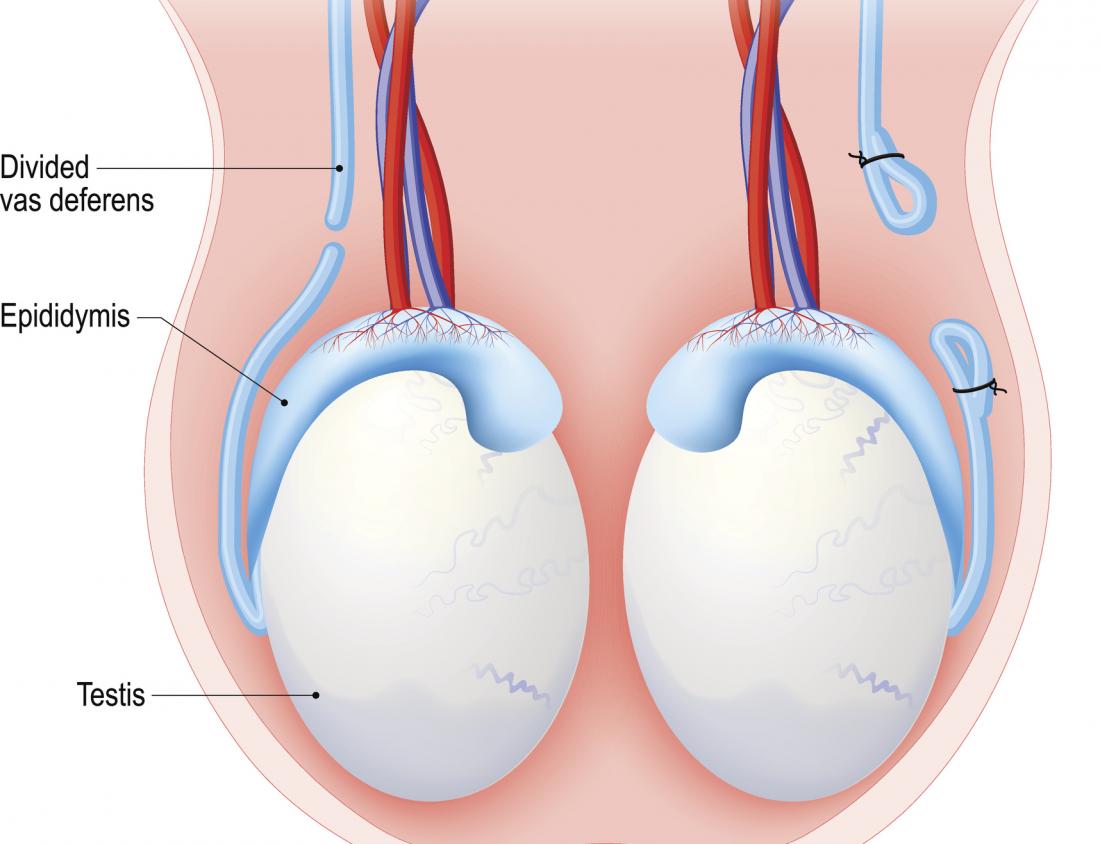 What to Expect After Your Vasectomy: Urology Specialist Group