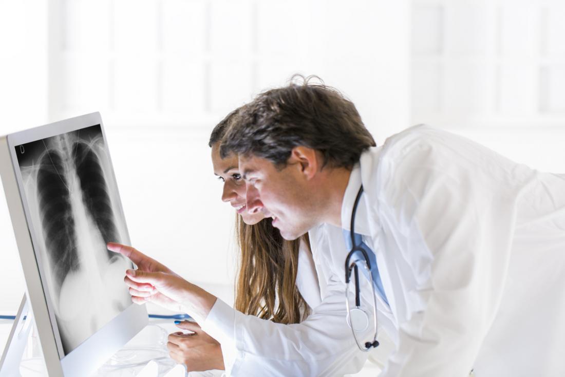 Doctors look at x-ray of lung.