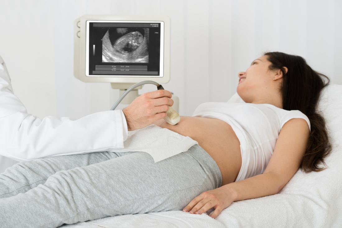 caput succedaneum ultrasound