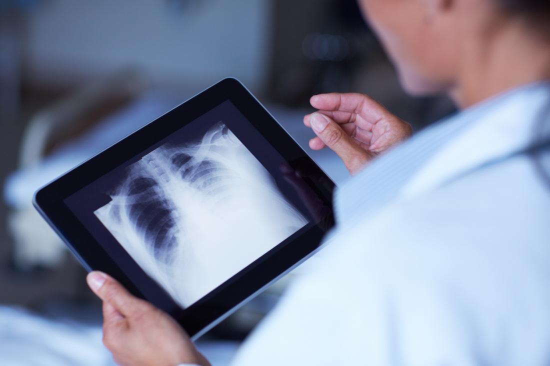 doctor looking at X-Ray