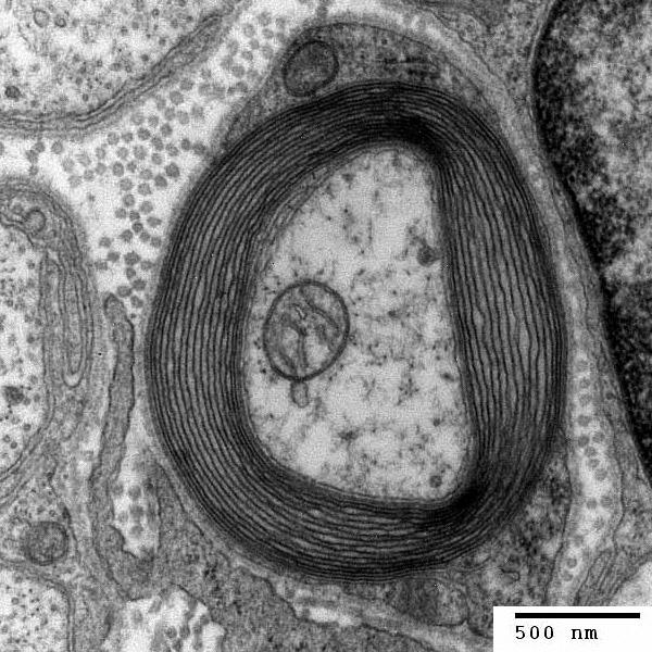 Myelinated axon. Image credit Roadnottaken