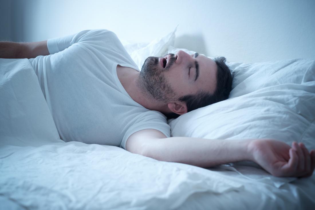 Pickwickian syndrome is when breathing in sleep is disordered.