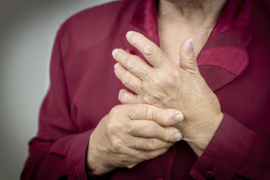 rheumatoid arthritis in hands