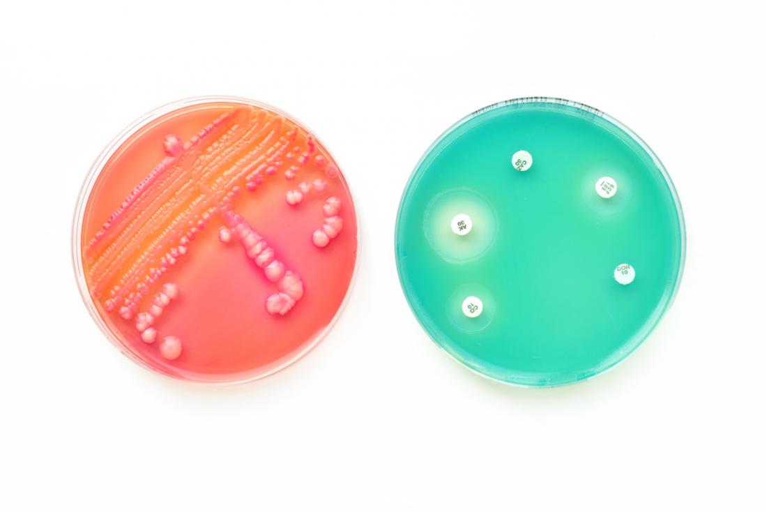 bacteria in petri dish