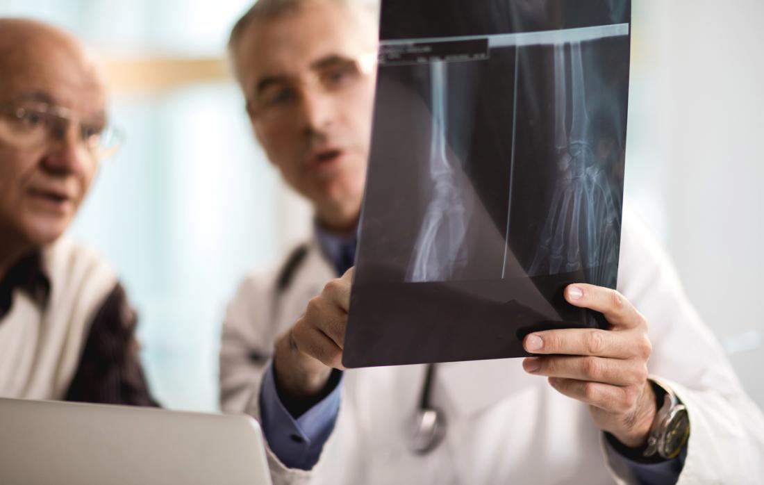 X-ray of broken arm.