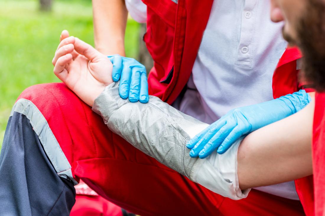 burn being treated