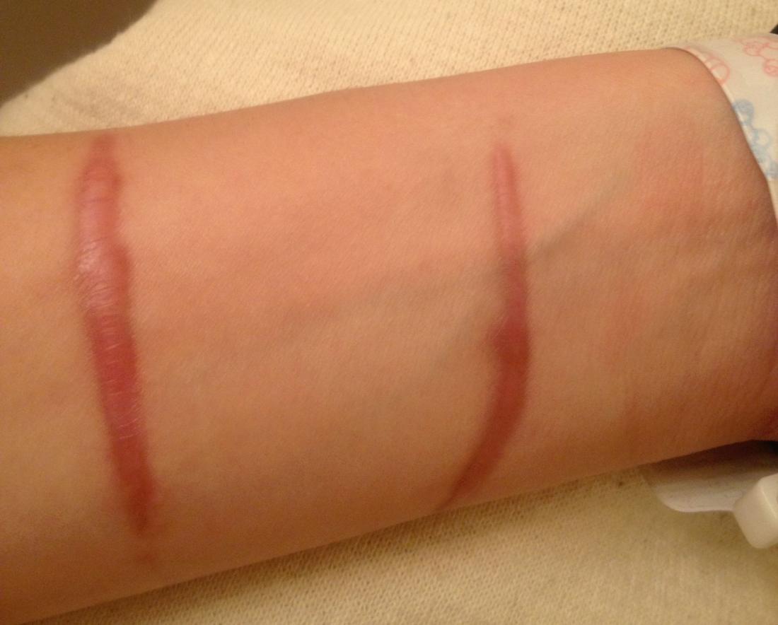 Purple my scar turn why did WHY DO