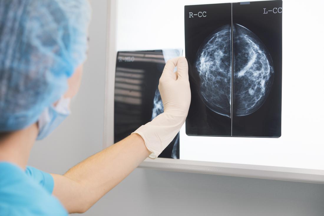 Mammograms may be used to diagnose triple-negative breast cancer.