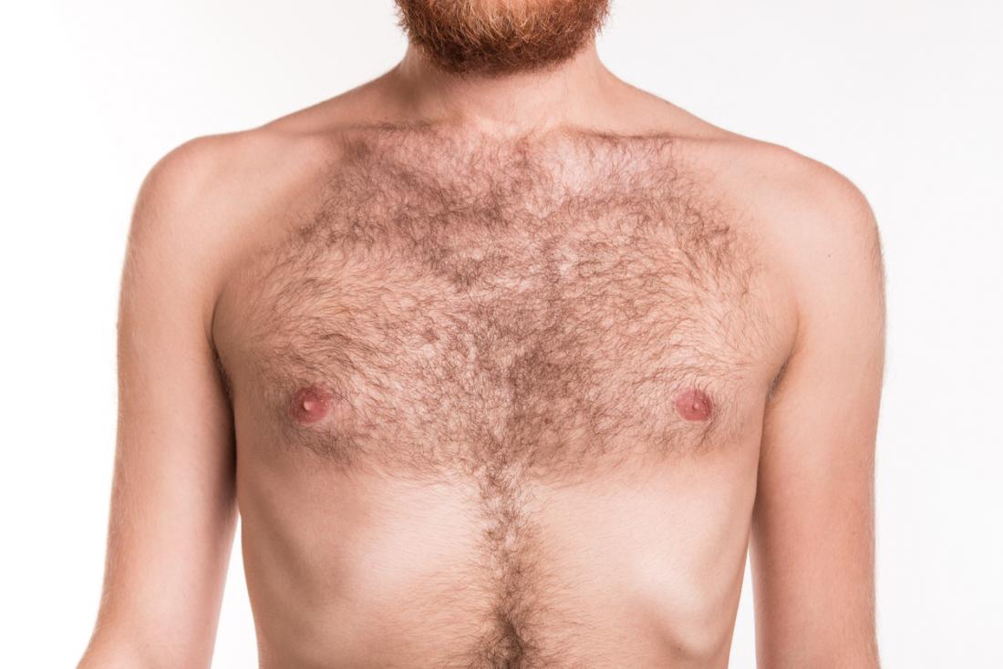 Nipple on male bump white Breast cancer
