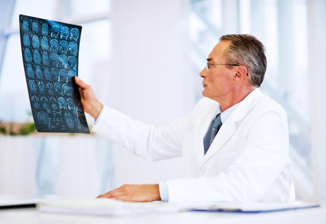 doctor looking at brain MRI scans