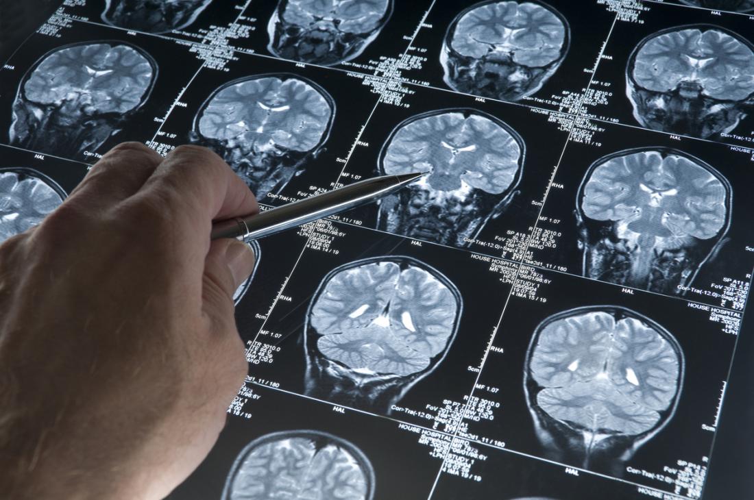 a doctor looking at brain scans