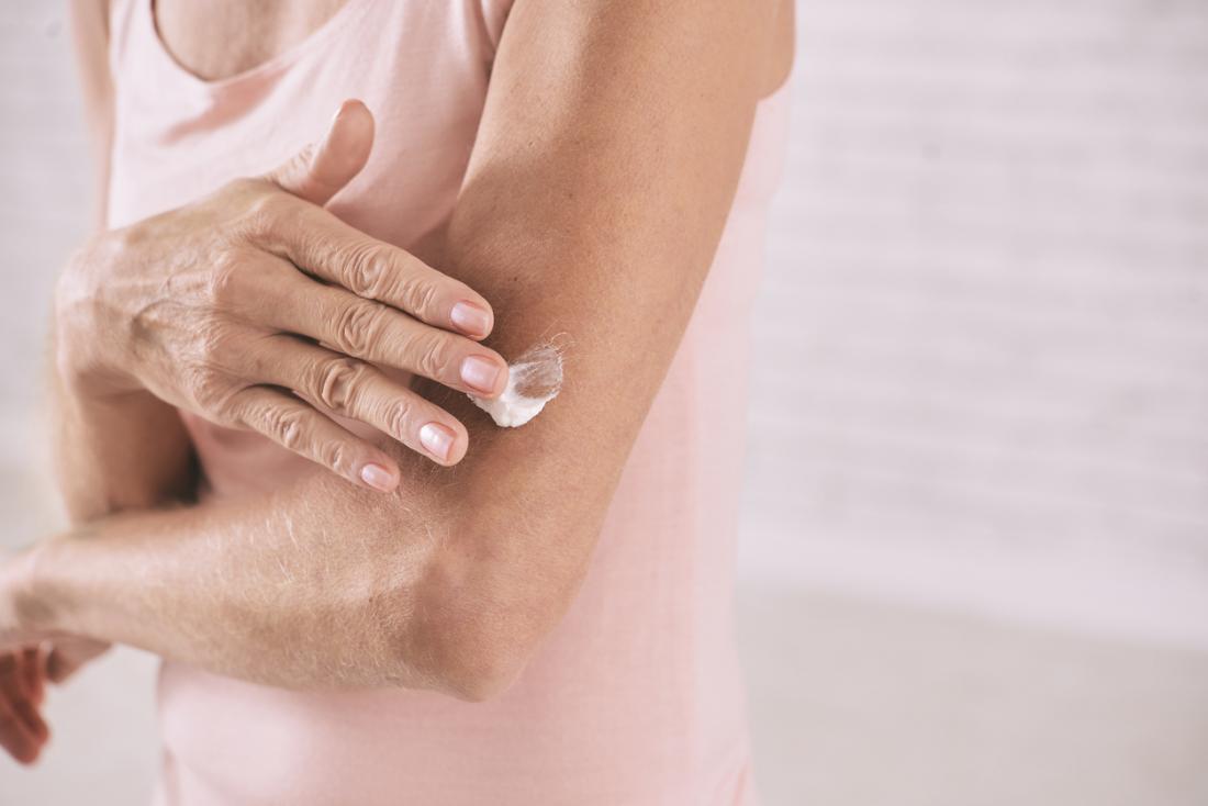 mature woman applying skin lotion to her arm.