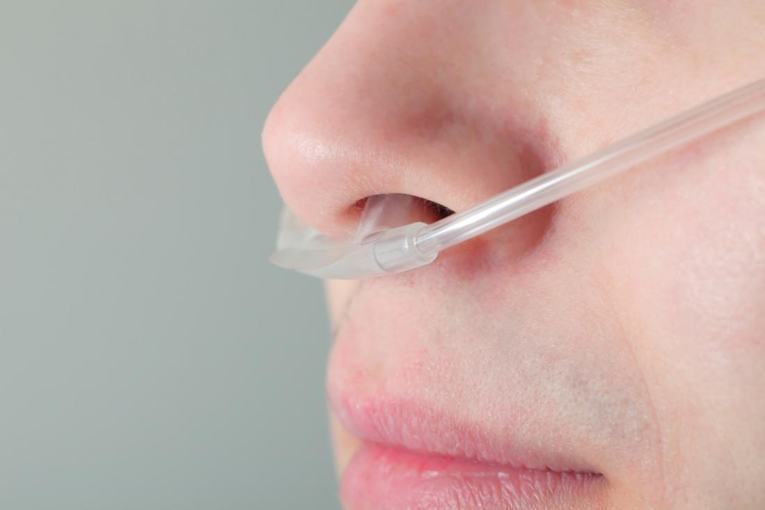 Woman undergoing oxygen therapy, close-up of breathing tubes in her nose.