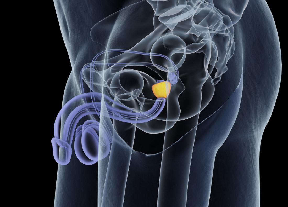 Prostate Nodule Causes Changes And Diagnosis