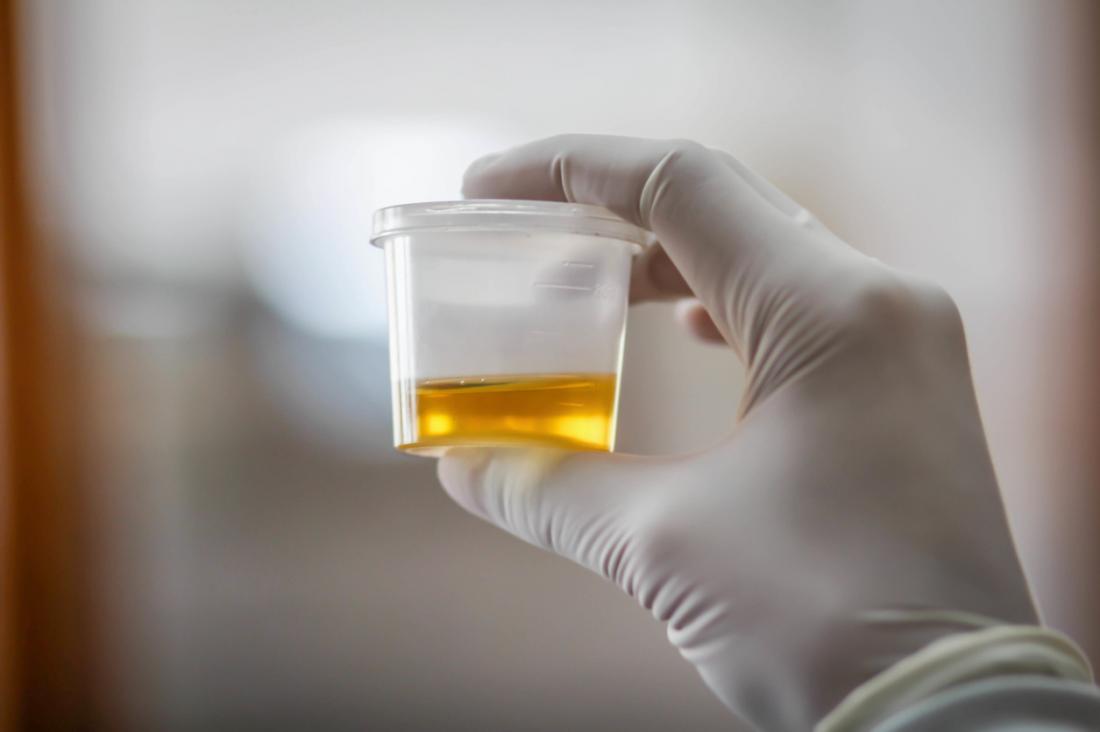 urologist urine sample