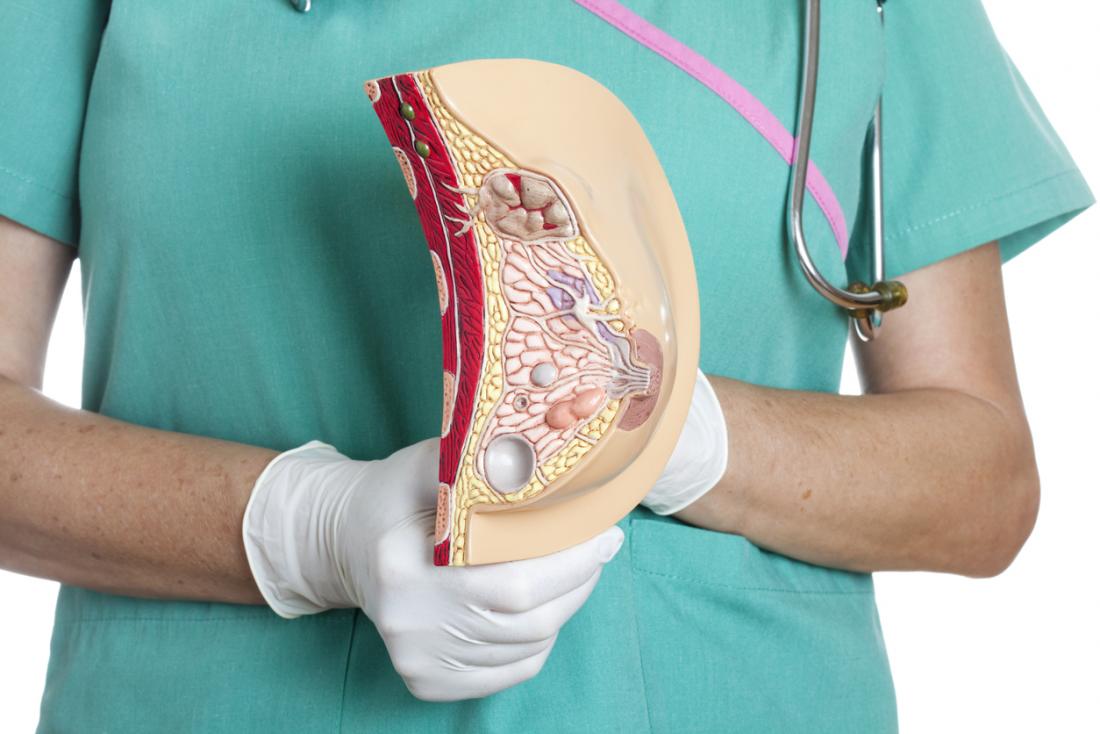 breast tissue model