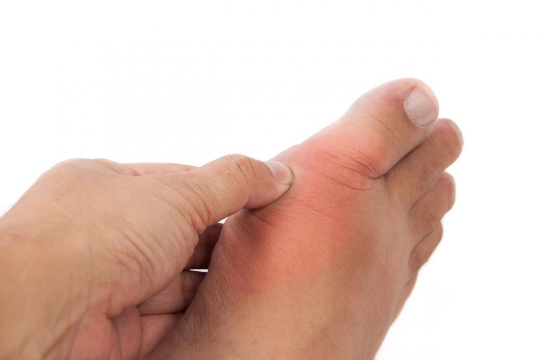 swollen top of foot causes