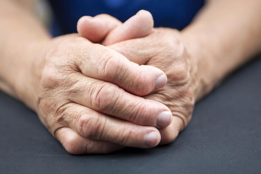 Rheumatoid arthritis in senior persons clasped hands.