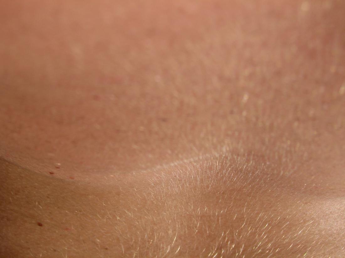 close up image of fine hair on human skin