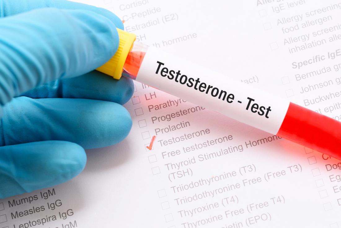 Men's Testosterone Test - Life Line Screening