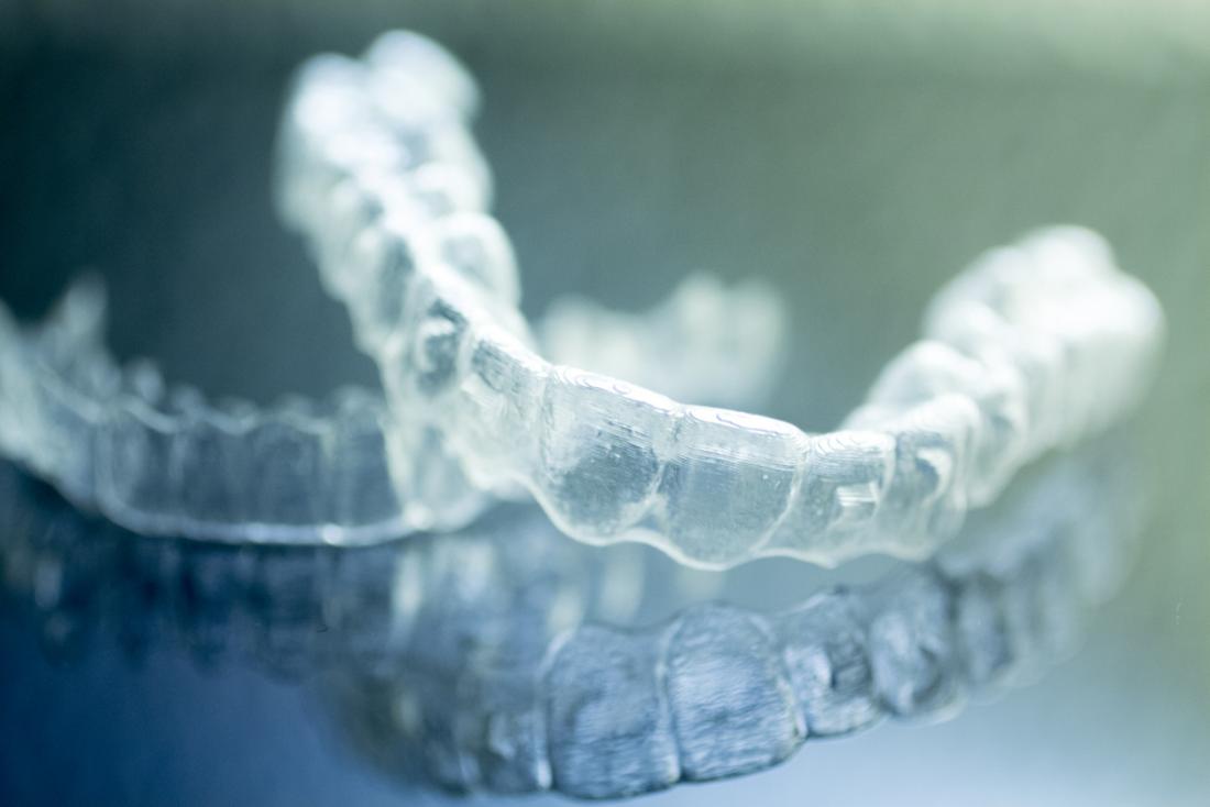 Retainer mouth guard used to prevent bruxism or teeth grinding.