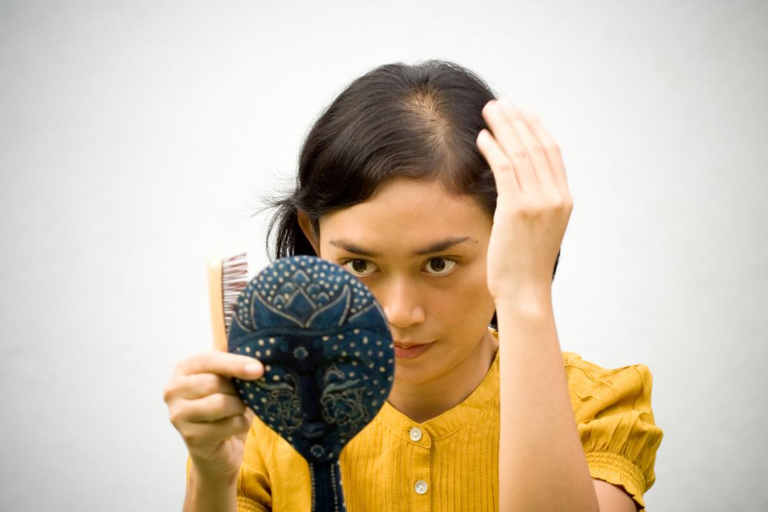 woman experiencing hair thinning and hair loss